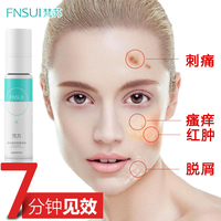 FnSui/梵苏晒后修护舒缓喷雾保湿补水消除色素敏感肌肤专用护肤品