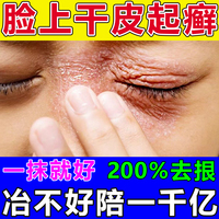 脸上过敏起癣长癣干燥起皮眼皮癣过敏皮肤修复脸部红疹痒痘激素脸
